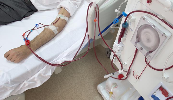 15 Nutritional Advice for Kidney Patients on&nbsp;Dialysis