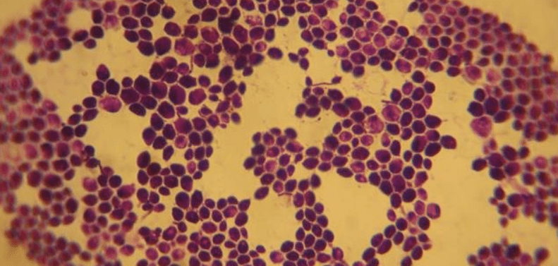 Nutrition for Candidiasis